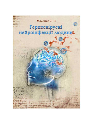 Герпесвірусні нейроінфекції людини